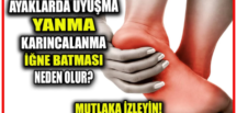 Ayaklarda Yanma/Ağrı Sebepleri vede T’edavi Y’öntemleri..