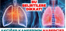 Kadınlarda Akciğer K-a’n serinin İlk Belirtisi..