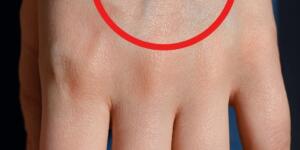 Eğer görünür damarların varsa öylesin demektir..