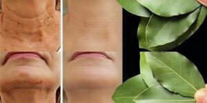 Defne yaprağı, doğal bakımda