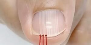 40 Yaşından Sonra Tırnağınızda Bu Çizgiler Varsa, Bu Çok Açık Bir İşaretti