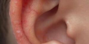 Doktor oğlumun kulağına eğilip bakınca, birden b’ağırdı ve “herkes dışarı çıksın”