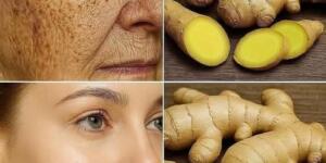 Zencefil; derin kırışıklıkları, çilleri ve siyah noktaları gidermede