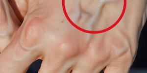 Seninde görünür damarların varsa öylesin demektir..