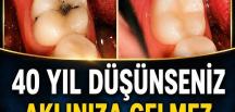 Uzmanından sağlıklı dişler içindir!