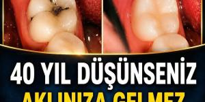 Uzmanından sağlıklı dişler içindir!